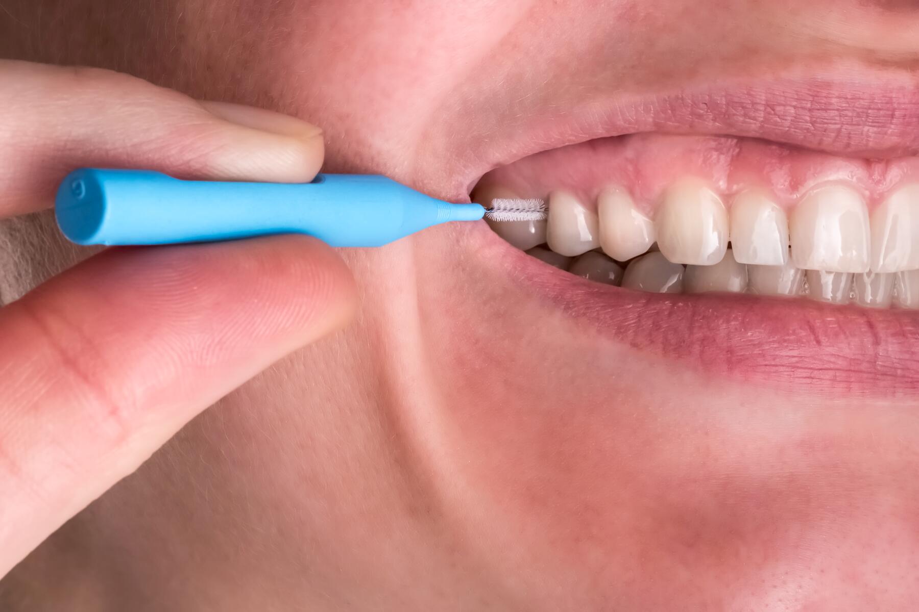 1. La brossette pour nettoyer entre les dents.